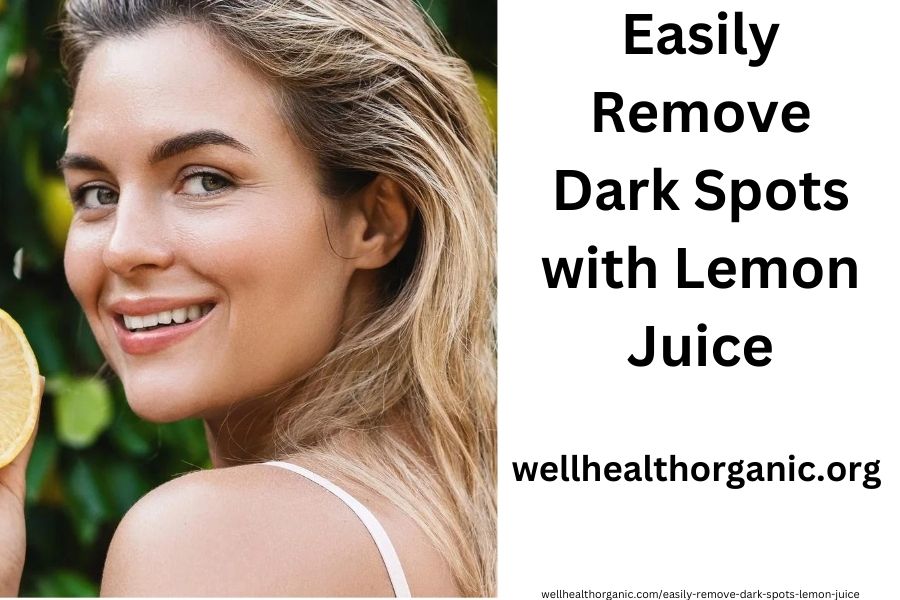 Easily Remove Dark Spots with Lemon Juice