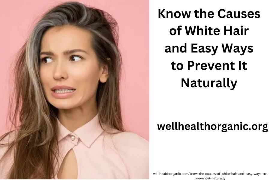 wellhealthorganic.com/know-the-causes-of-white-hair-and-easy-ways-to-prevent-it-naturally